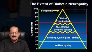 Diabetes and Severe Neuropathy Treatment by Dr Rajeev Chawla [upl. by Werdnaed]