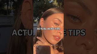 6 Actual Acne Tips viralshorts acnetreatment acnescars [upl. by Odlanra]