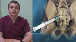 Лечение боли в спине  Блокада крестцовоподвздошных сочленений  Sacroiliac Joint Injection [upl. by Marnie]