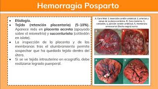 Hemorragia Posparto 12  Ginecología [upl. by Gnex]