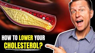 URGENT MUSTEAT Foods That SLASH Cholesterol Levels FAST  Dr Eric Berg [upl. by Reteip97]