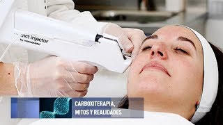 Mitos y realidades de la carboxiterapia [upl. by Baily203]