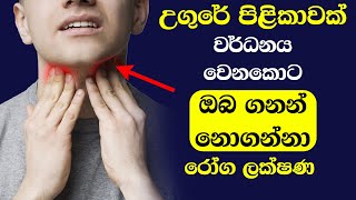 Symptoms Of Throat Cancer [upl. by Ping297]