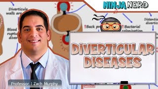 Diverticular Diseases  Clinical Medicine [upl. by Annal]