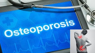 OSTEOPOROSIS education bones osteoporosis bonedisease anatomy physiology science diseases [upl. by Aitrop339]