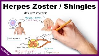 Herpes ZosterShingles Symptoms Diagnosis Treatment [upl. by Rebmat371]