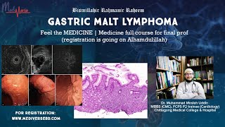 Davidsons 24th e review  Gastric MALToma [upl. by Nnazus]