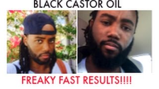 Black Castor Oil  How to quickly get THICKER hair Beard eyebrows eye lashes EDGES [upl. by Ai]