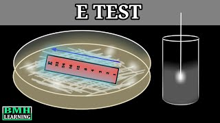 E Test  E Test For Antibiotic Susceptibility  MIC Determination By E Test  Epsilometer Test [upl. by Elehcar454]