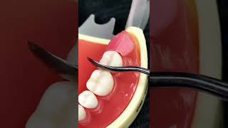 How to fill the gap after removing the corner teeth in the mouth shortvideo newbornbaby dentalcar [upl. by Nojid]