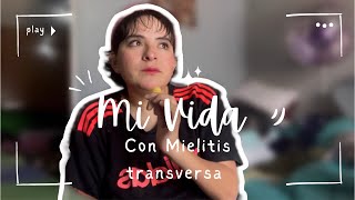 Volví ❤️‍🩹 Por esta razón dejé de caminar😞 Mi vida con Mielitis Transversa 🧠👩🏻‍🦽‍➡️ [upl. by Vaules]