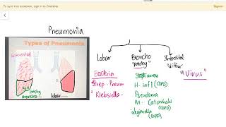 Types of Pneumonia  Lobar  Bronchopneumonia  Interstitial  Diffuse [upl. by Voccola990]