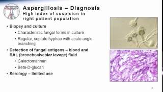 Aspergillosis [upl. by Aissela689]