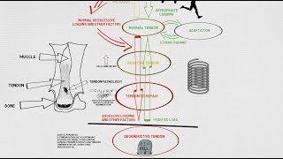 Tendinopathy Continuum and Update [upl. by Nocaed947]