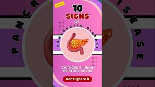 10  Pancreatic Disease Alert Dark Urine or Pale Stools Warning Signs You Shouldn’t Ignore [upl. by Elrebma]