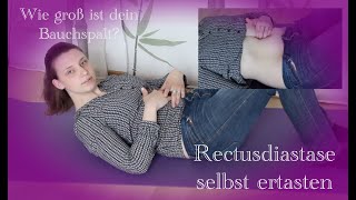 Rektusdiastase selbst ertasten [upl. by Xino]