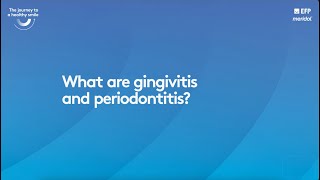 What are gingivitis and periodontitis  complete version [upl. by Biancha]