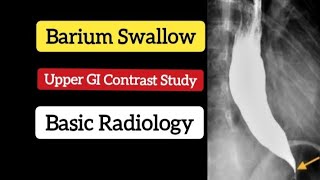 Barium swallow  Upper GI contrast study  Basic Radiology [upl. by Annait213]