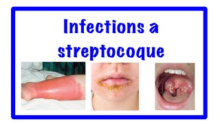 🔵infection à streptocoque 👹 streptococcies [upl. by Notfa]