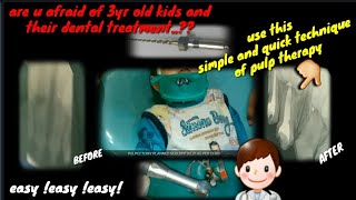 how to do rct in a 3 year child  step by step [upl. by Alia389]