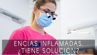 Encías inflamadas por qué se inflaman y tratamiento para la inflamación [upl. by Kauppi69]