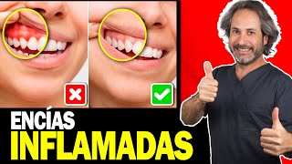 😨 Que hacer si tengo ENCIAS INFLAMADAS Y SANGRANTES  Causas y Tratamientos Que SI FUNCIONAN ✅ [upl. by Quickman]