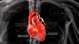 What is atrial fibrillation [upl. by Stoeber653]