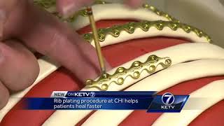 Rib plating procedure at CHI helps patients heal faster [upl. by Alletniuq]