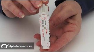 Faecal Immunochemical Test FIT Sampling Instructions [upl. by Kcorb823]