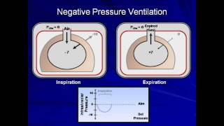 An Introduction to Mechanical Ventilation Mechanical Ventilation  Lecture 1 [upl. by Efinnej888]