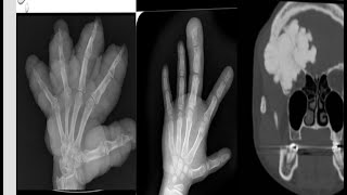 Msk spotters 2 radiology 15 cases in 15 minutes radiopedia mrictxrayultrasoundanazomybasics [upl. by Heshum680]