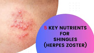 5 Key nutrients for Shingles Herpes Zoster [upl. by Jolenta]