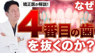 前歯を下げる！矯正で４番の歯を抜く理由と他の歯でも口ゴボを改善できる症例を解説【審美歯科 歯列矯正 Eライン】 [upl. by Kal]