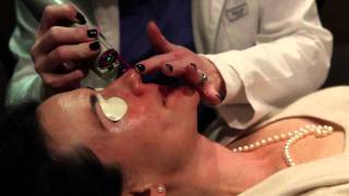 Laser treatment for Rosacea Birmingham Alabama  Cosmetic Dermatology [upl. by Einnoc]