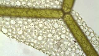 Hydrodictyon a netlike green alga [upl. by Aveline]