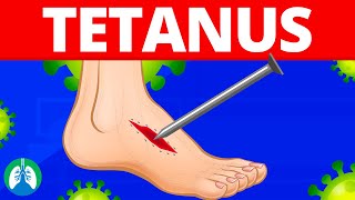 Tetanus Medical Definition  Quick Explainer Video [upl. by Norehc]