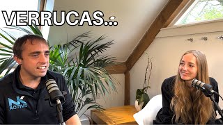 What is the best verruca treatment  Is it Swift verruca treatment  podiatry podcasts [upl. by Onimixam578]