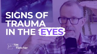 What Your Eyes Tell You About Trauma [upl. by Eseela]