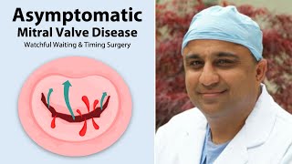 Surgeon QampA The Risk Vs Benefit of Asymptomatic Mitral Valve Surgery [upl. by Nirrac740]