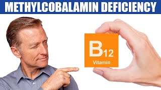 The 1st Sign of a Methylcobalamin B12 Deficiency [upl. by Arabella]