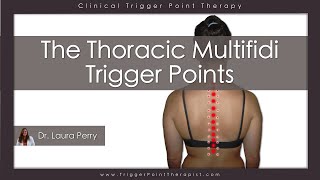 The Thoracic Multifidi Trigger Points [upl. by Rosenfeld]