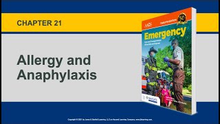 Chapter 21 Allergy and Anaphylaxis [upl. by Ethelin]