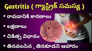 Gastritis Causes  Symptoms and Treatment in Telugu [upl. by Enelhtac]