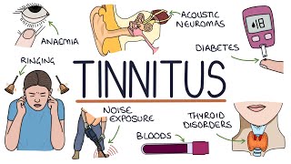 Understanding the Causes of Tinnitus [upl. by Acnairb472]