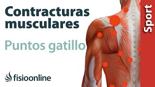 3 cosas que debes saber sobre las contracturas musculares y los puntos gatillo [upl. by Lrac]