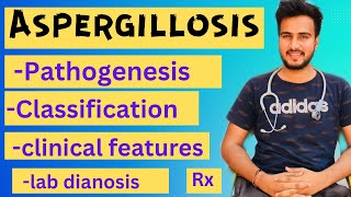 Aspergillosis microbiologymorphologypathogenesislabdiagnosisTreatment [upl. by Aticnemrac]