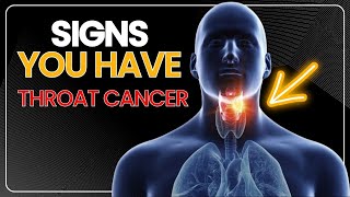 10 Signs You Have Throat Cancer [upl. by Farlie]