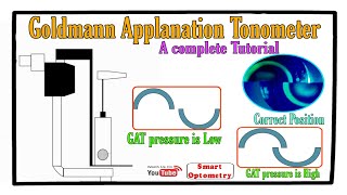 Goldmann Applanation Tonometer  Complete Tutorial [upl. by Alano853]