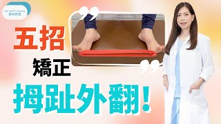 五招矯正拇趾外翻 脊醫王鳳恩中Eng Sub  Five Exercises to Improve Bunions  Dr Matty Wong Chiropractor [upl. by Alcock169]