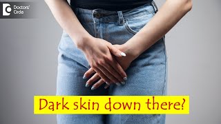 Dark skin of private parts in women Causes amp How to lighten it  Dr Regina JosephDoctors Circle [upl. by Akinihs]